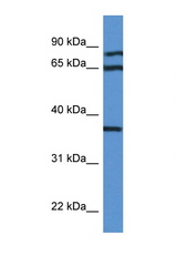 DHPS antibody LS-C135946 Western blot of MCF7 Cell lysate. Antibody concentration 1 ug/ml.