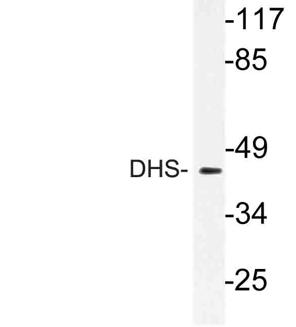 Western blot of DHS (L87) pAb in extracts from 3T3 cells.