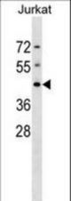 DHPS Antibody western blot of Jurkat cell line lysates (35 ug/lane). The DHPS antibody detected the DHPS protein (arrow).