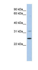DHRS1 antibody LS-C111415 Western blot of 721_B cell lysate.