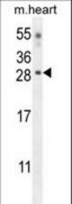 CLDN6 Antibody western blot of mouse heart tissue lysates (35 ug/lane). The CLDN6 antibody detected the CLDN6 protein (arrow).