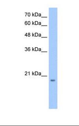 HepG2 cell lysate. Antibody concentration: 0.5 ug/ml. Gel concentration: 12%.