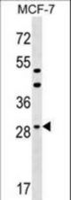 DHRS11 Antibody western blot of MCF-7 cell line lysates (35 ug/lane). The DHRS11 antibody detected the DHRS11 protein (arrow).