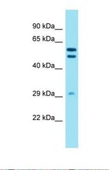 Western blot of Human A549. DHRS12 antibody dilution 1.0 ug/ml.