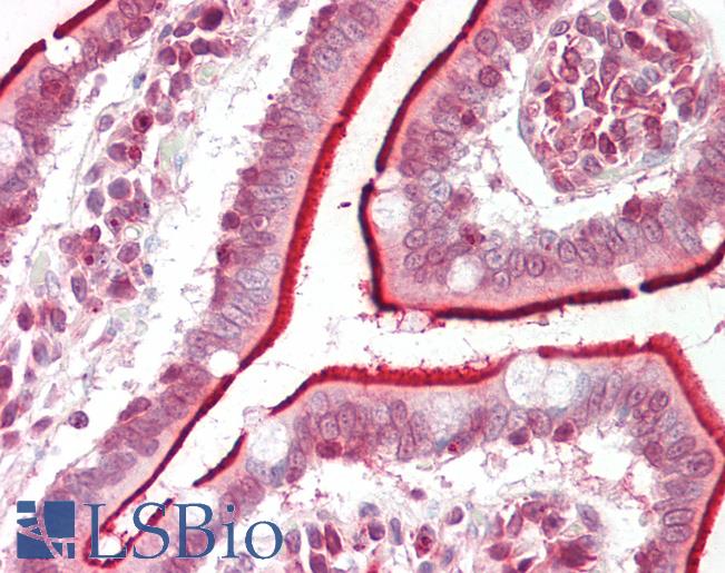 Human Small Intestine: Formalin-Fixed, Paraffin-Embedded (FFPE)