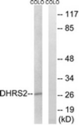 Western blot of extracts from COLO cells, using DHRS2 Antibody. The lane on the right is treated with the synthesized peptide.