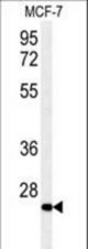 DHRS2 Antibody western blot of MCF-7 cell line lysates (35 ug/lane). The DHRS2 antibody detected the DHRS2 protein (arrow).
