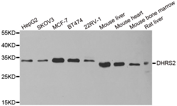 Western blot analysis of extracts of various cell lines, using DHRS2 antibody.