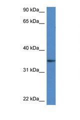 DHRS3 antibody LS-C145214 Western blot of Mouse Spleen lysate. Antibody concentration 1 ug/ml.