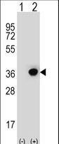 Western blot of DHRS3 (arrow) using rabbit polyclonal DHRS3 Antibody. 293 cell lysates (2 ug/lane) either nontransfected (Lane 1) or transiently transfected (Lane 2) with the DHRS3 gene.