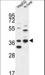 DHRS3 Antibody western blot of HepG2 cell line and mouse liver tissue lysates (35 ug/lane). The DHRS3 antibody detected the DHRS3 protein (arrow).