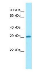 DHRS4 / PSCD antibody Western Blot of COLO205.