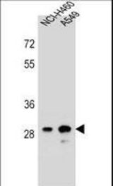 DHRS4L1 Antibody western blot of NCI-H460,A549 cell line lysates (35 ug/lane). The DHRS4L1 antibody detected the DHRS4L1 protein (arrow).