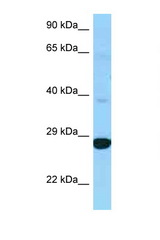 DHRS4L2 antibody LS-C146302 Western blot of 721_B Cell lysate. Antibody concentration 1 ug/ml.