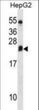 DHRS4L2 Antibody western blot of HepG2 cell line lysates (35 ug/lane). The DHRS4L2 Antibody detected the DHRS4L2 protein (arrow).