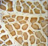 DHRS7 Antibody immunohistochemistry of formalin-fixed and paraffin-embedded human skeletal muscle followed by peroxidase-conjugated secondary antibody and DAB staining.