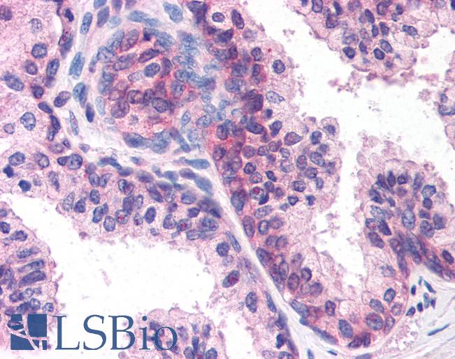 Anti-DHRS7 antibody LS-A9864 IHC of human prostate. Immunohistochemistry of formalin-fixed, paraffin-embedded tissue after heat-induced antigen retrieval.