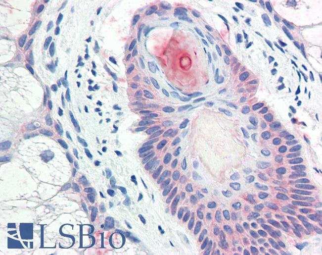 Anti-DHRS7 antibody LS-A9864 IHC of human skin, pilosebaceous unit. Immunohistochemistry of formalin-fixed, paraffin-embedded tissue after heat-induced antigen retrieval.