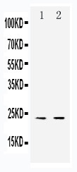 WB of CLDN6 / Claudin 6 antibody. Lane 1: HELA Cell Lysate. Lane 2: SMMC Cell Lysate..