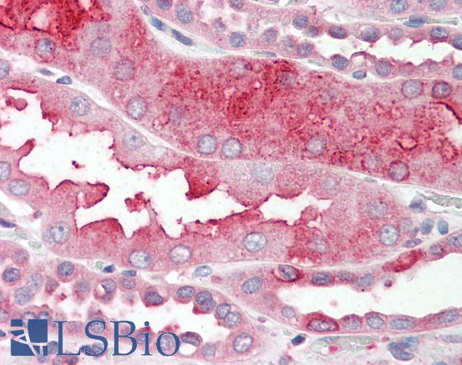 Anti-DHRS7 antibody LS-A8235 IHC of human kidney. Immunohistochemistry of formalin-fixed, paraffin-embedded tissue after heat-induced antigen retrieval.