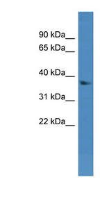 DHRS7 antibody LS-C135004 Western blot of Mouse Liver lysate.