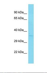 Western blot of Human Placenta. DHRS7C antibody dilution 1.0 ug/ml.