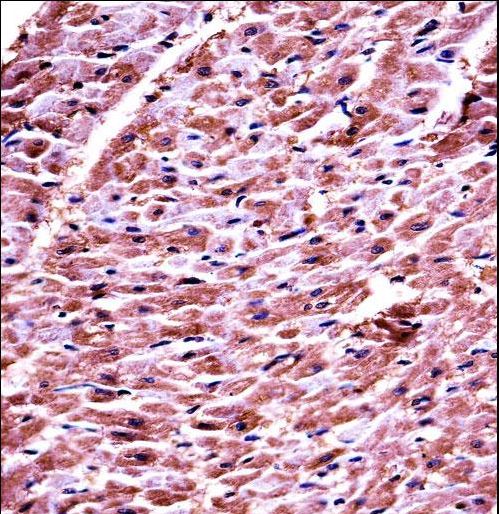 DHRS7C Antibody immunohistochemistry of formalin-fixed and paraffin-embedded human heart tissue followed by peroxidase-conjugated secondary antibody and DAB staining.