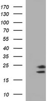 HEK293T cells were transfected with the pCMV6-ENTRY control (Left lane) or pCMV6-ENTRY CLDN6 (Right lane) cDNA for 48 hrs and lysed. Equivalent amounts of cell lysates (5 ug per lane) were separated by SDS-PAGE and immunoblotted with anti-CLDN6.