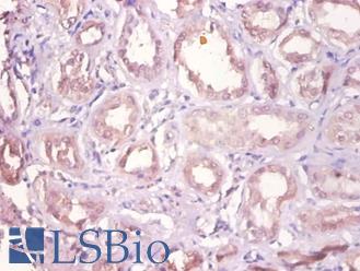 Immunohistochemistry of paraffin-embedded human kidney using DHRS9 antibody at dilution of 1:100.