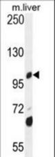 DHTKD1 Antibody western blot of mouse liver tissue lysates (35 ug/lane). The DHTKD1 antibody detected the DHTKD1 protein (arrow).