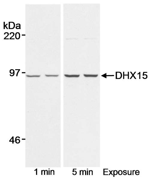Detection of Human DHX 15 by Western Blot. Samples: Whole cell lysate (55 ug/lane) from normal human lymphoblasts. Antibody: Affinity purified rabbit anti-DHX15 antibody used at 0.1 ug/ml. Detection: Chemiluminescence with exposure times of 1 and 5 minutes.