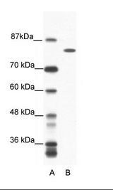 A: Marker, B: Jurkat Cell Lysate