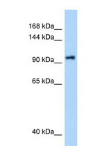 DHX16 antibody LS-C146081 Western blot of PANC1 Cell lysate. Antibody concentration 1 ug/ml.
