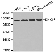 Western blot analysis of extracts of various cell lines, using DHX16 antibody.
