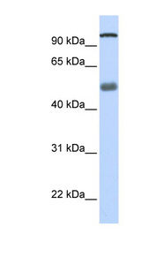 DHX32 antibody LS-C101630 Western blot of Fetal Lung lysate.