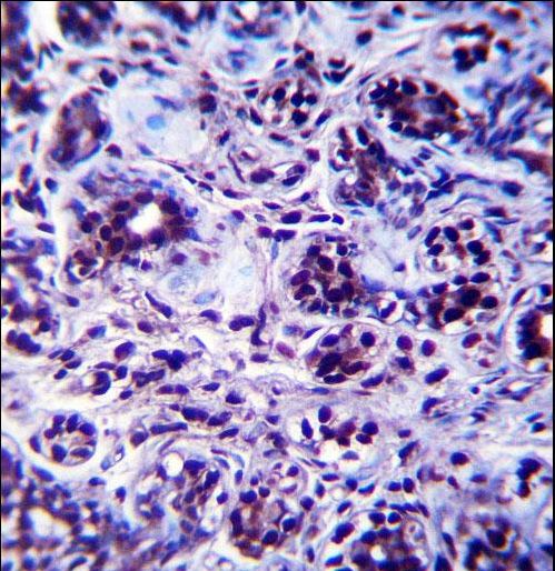 DHX32 Antibody immunohistochemistry of formalin-fixed and paraffin-embedded human breast tissue followed by peroxidase-conjugated secondary antibody and DAB staining.