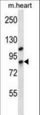 DHX32 Antibody western blot of mouse heart tissue lysates (35 ug/lane). The DHX32 antibody detected the DHX32 protein (arrow).