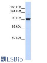 DHX34 antibody Western Blot of 293T cell lysate.