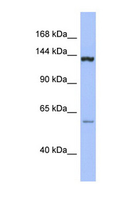 DHX34 antibody LS-C110156 Western blot of THP-1 cell lysate.