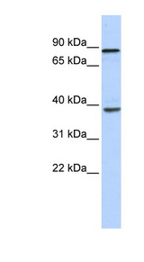DHX35 antibody LS-C101633 Western blot of Fetal Heart lysate.