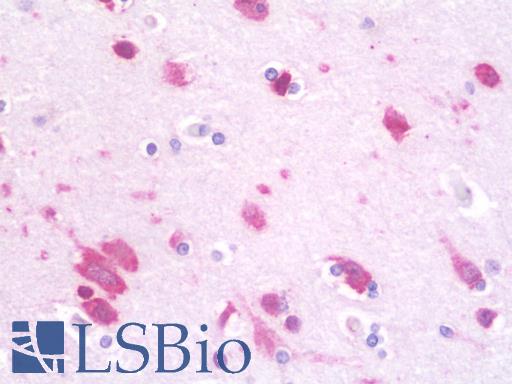 Anti-DHX36 antibody IHC staining of human brain, cortex. Immunohistochemistry of formalin-fixed, paraffin-embedded tissue after heat-induced antigen retrieval. Antibody LS-B10068 concentration 10 ug/ml.