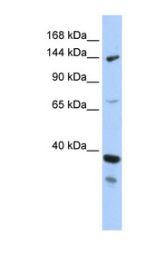 DHX37 antibody LS-C110170 Western blot of MCF7 cell lysate.
