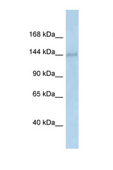 DHX38 antibody LS-C145318 Western blot of Rat Brain lysate. Antibody concentration 1 ug/ml.