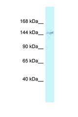 DHX38 antibody LS-C145855 Western blot of 3 Cell lysate. Antibody concentration 1 ug/ml.