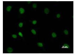 Immunofluorescent staining using DHX38 antibody. Immunostaining analysis in HeLa cells. HeLa cells were fixed with 4% paraformaldehyde and permeabilized with 0.01% Triton-X100 in PBS. The cells were immunostained with anti-DHX38 antibody.