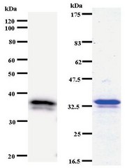 Western blot of immunized recombinant protein using DHX38 antibody. Left: DHX38 staining. Right: Coomassie Blue staining of immunized recombinant protein.