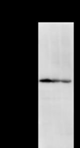 Detection of DHX38 by Western blot. Samples: Whole cell lysate from human HeLa (H, 50 ug) , mouse NIH3T3 (M, 50 ug) and rat F2408 (R, 50 ug) cells. Predicted molecular weight: 140 kDa