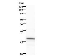 Western blot analysis of immunized recombinant protein, using anti-DHX57 monoclonal antibody.