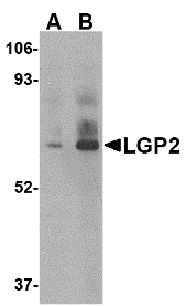 Western blot of LGP2 in rat kidney tissue lysate with LGP2 antibody at (A) 1 and (B) 2 ug/ml.