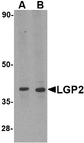 Western blot of LGP2 in MDA-MB-361 cell lysate with LGP2 antibody at (A) 0.5 and (B) 1 ug/ml.